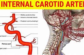 Image result for Internal Carotid Artery