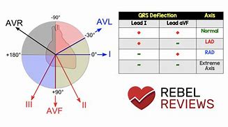 Image result for Heart Axis ECG