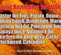 Image result for Home Remedies for Plantar Warts