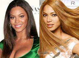 Image result for Beyoncé Skin Lightener