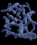 Image result for Picture of Archaebacteria
