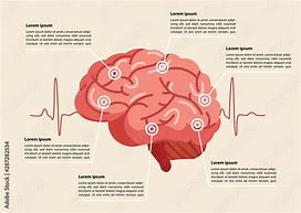 Image result for Brain Anatomy and Stroke