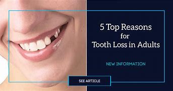 Image result for Tooth Bone Loss