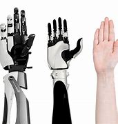 Image result for Robot Arm Prosthesis