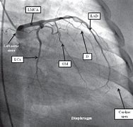 Image result for What Is a Angiogram