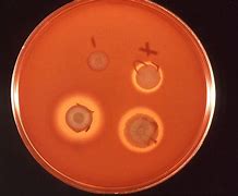 Image result for Chlamydia Trachomatis Culture Plate