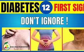 Image result for Diabetes Signs and Symptoms