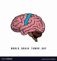 Image result for Brain Tumor Cartoon
