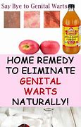 Image result for genital wart home remedy