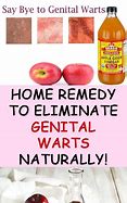Image result for Genital Wart Natural Treatment