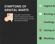 Image result for Genital Wart Locations