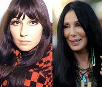 Image result for Cher Surgery