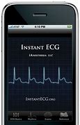 Image result for iPhone ECG App