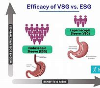 Image result for ESG vs VSG