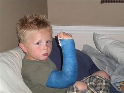 Image result for Kid Broke Arm