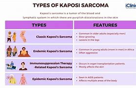 Image result for Kaposi Sarcoma Nose