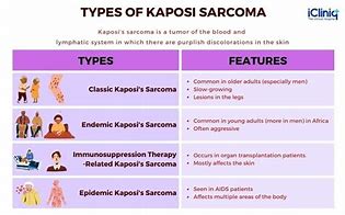 Image result for Kaposi's Sarcoma Causes