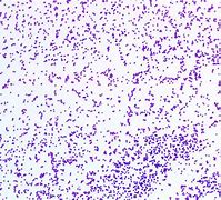 Image result for Staphylococcus Aureus Gram Stain
