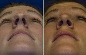 Image result for Boxy Nose Tip