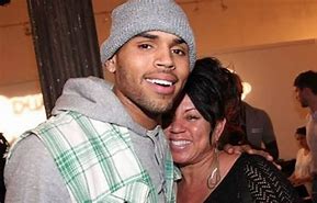 Image result for Chris Brown Plastic Surgery