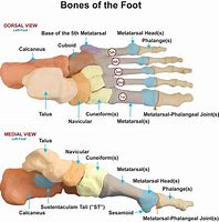 Image result for 5th Metatarsal Base