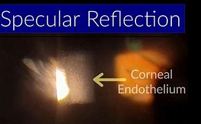 Image result for Specular Reflection Slit Lamp
