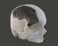 Image result for 3D Print Titanium