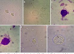 Image result for Trichomoniasis Eggs