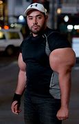 Image result for World's Biggest Biceps