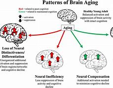 Image result for Elderly Brain