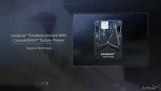 Image result for Magnum 2 Knotless Implant