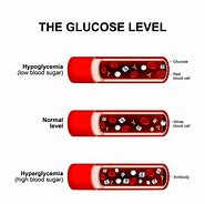 Image result for Diabetes High Blood Sugar