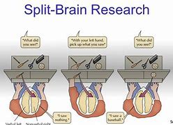 Image result for Split Brain Syndrome