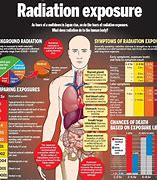 Image result for Nuclear Radiation Exposure