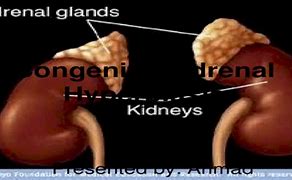 Image result for axrenal