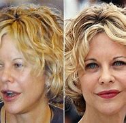 Image result for Meg Ryan Without Makeup