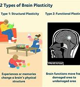 Image result for Brain Plasticity