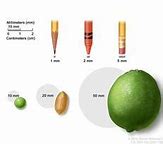 Image result for 9Mm Tumor Image Size