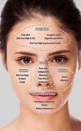 Image result for Hormonal Spots Face Mapping