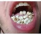 Image result for Cursed Teeth