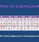 Image result for Homozygous Lood Bank Panel Cells