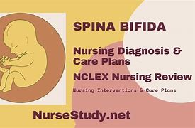Image result for Spina Bifida Diagnosis