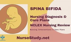 Image result for Spina Bifida Signs and Symptoms