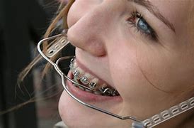 Image result for Beautiful Braces Headgear