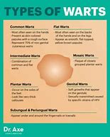 Image result for Get Rid of Genital Warts