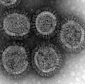 Image result for Influenza A Virus Subtype H5N1