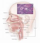 Image result for Head and Neck Cancer Tissue Biopsy