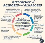 Image result for acetosidsd