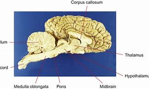 Image result for Horse Brain