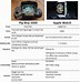 Image result for Apple Watch 3 vs 4